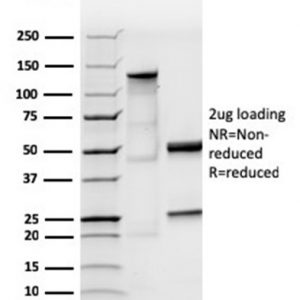 SDS-PAGE Analysis of Purified IgA Recombinant Rabbit Monoclonal Antibody (IGHA/3877R). Confirmation of Purity and Integrity of Antibody.