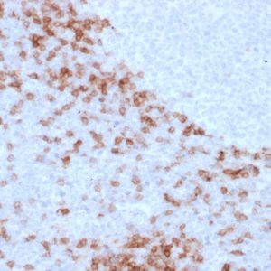 Formalin-fixed, paraffin-embedded human lymph node stained with IgD Mouse Monoclonal Antibody (IGD26). HIER: Tris/EDTA, pH9.0, 45min. 2°C: HRP-polymer, 30min. DAB, 5min.