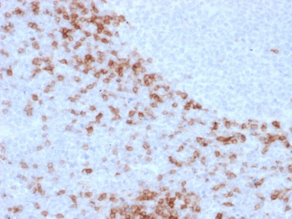 Formalin-fixed, paraffin-embedded human lymph node stained with IgD Mouse Monoclonal Antibody (IGD26). HIER: Tris/EDTA, pH9.0, 45min. 2°C: HRP-polymer, 30min. DAB, 5min.