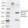 IgG4 (Ig Heavy Constant Gamma 4) (G4m Marker) Antibody - Image 2