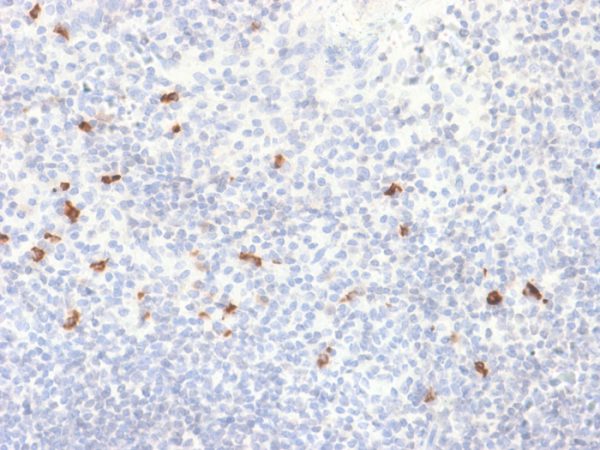 Formalin-fixed, paraffin-embedded human Tonsil stained with IgG4 Recombinant Rabbit Monoclonal Antibody (IGHG4/2042R).