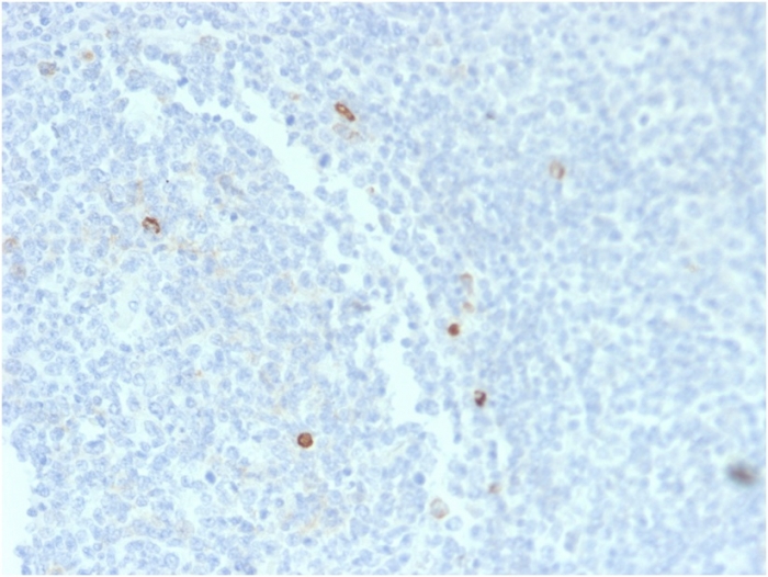 Recombinant IgM (Immunoglobulin Mu Heavy Chain) (B-Cell Marker ...