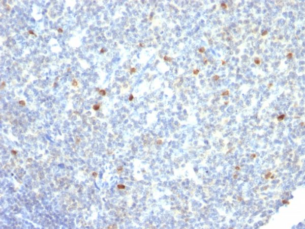 IgM (Immunoglobulin Mu Heavy Chain) (B-Cell Marker) Antibody