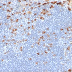 Formalin-fixed, paraffin-embedded human Tonsil stained with Kappa Light Chain Mouse Recombinant Monoclonal Antibody (rL1C1).