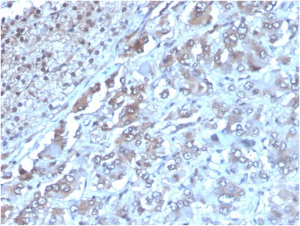 Formalin-fixed, paraffin-embedded human adrenal gland stained with Interleukin-2 (IL-2) Mouse Monoclonal Antibody (IL2/3949). HIER: Tris/EDTA, pH9.0, 45min. 2°C: HRP-polymer, 30min. DAB, 5min.