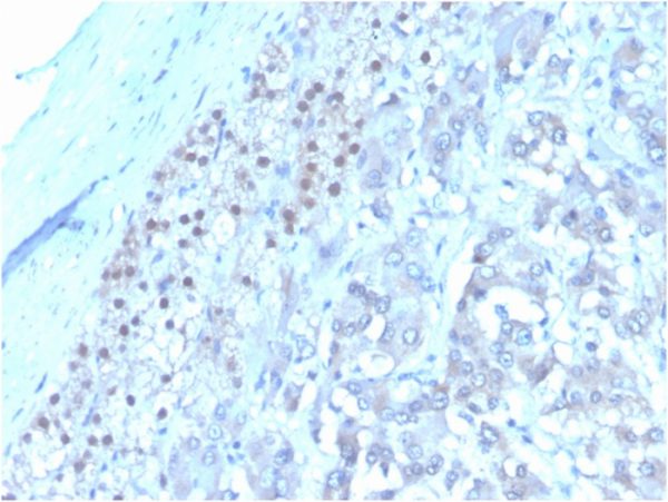 Formalin-fixed, paraffin-embedded human adrenalgland stained with Interleukin-3 (IL-3) Mouse Monoclonal Antibody(I L3/4001). HIER: Tris/EDTA, pH9.0, 45min. 2°C: HRP-polymer, 30min. DAB, 5min.