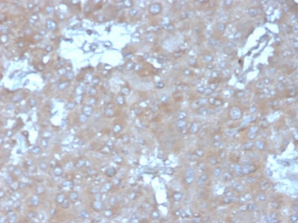 Formalin-fixed, paraffin-embedded human adrenal gland stained with Interleukin-15 (IL-15) Mouse Monoclonal Antibody (IL15/4355). HIER: Tris/EDTA, pH9.0, 45min. 2°C: HRP-polymer, 30min. DAB, 5min.