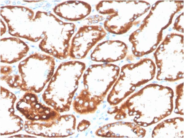 CD137 Antibody in Immunohistochemistry (IHC (P))