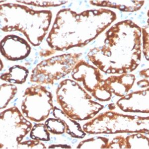 CD137 Antibody in Immunohistochemistry (IHC (P))