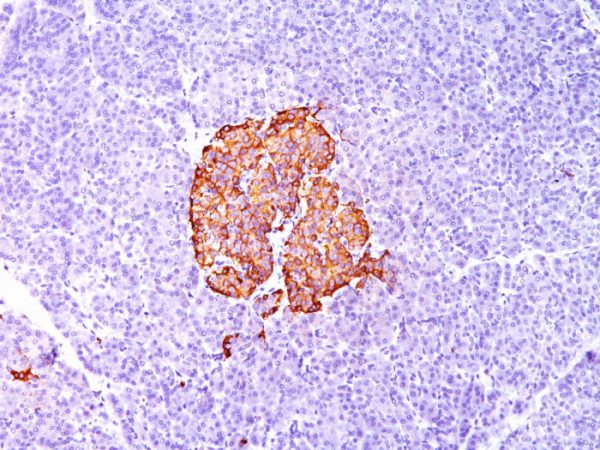 Formalin-fixed, paraffin-embedded human Pancreas stained with Insulin Monoclonal Antibody (SPM139).