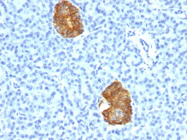 Formalin-fixed, paraffin-embedded human Pancreas stained with Insulin Mouse Monoclonal Antibody (E2-E3+2D11-H5).