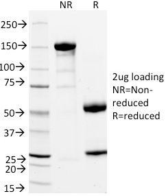 SDS-PAGE Analysis of Purified CD11a Mouse Monoclonal Antibody (DF1524). Confirmation of Integrity and Purity of Antibody.