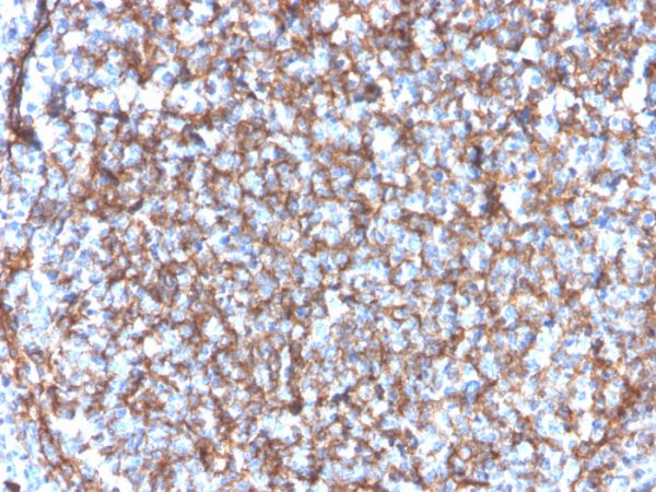 CD11b / MAC-1 (Microglial Marker) Antibody - Image 2