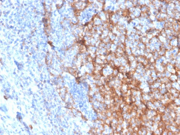 Formalin-fixed, paraffin-embedded human tonsil stained with CD11b Monospecific Mouse Monoclonal Antibody (ITGAM/3337).