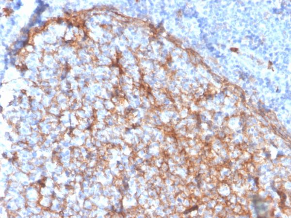 Formalin-fixed, paraffin-embedded human tonsil stained with CD11b Monospecific Mouse Monoclonal Antibody (ITGAM/3337).