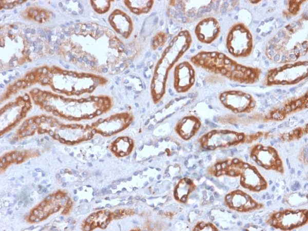 Formalin-fixed, paraffin-embedded human Spleen stained with CD61 Recombinant Mouse Monoclonal Antibody(rITGB3/1713).