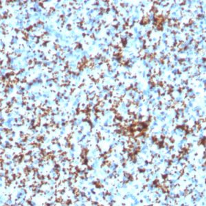 Formalin-fixed, paraffin-embedded human Spleen stained with CD61 Recombinant Rabbit Monoclonal Antibody (ITGB3/3126R).