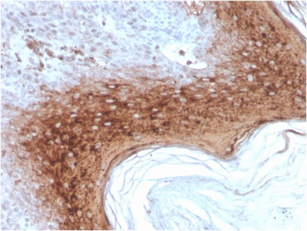 Recombinant Involucrin (Squamous Cell Terminal Differentiation Marker) Antibody