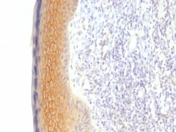 Formalin-fixed, paraffin-embedded human Skin stained with Catenin, gamma Monoclonal Antibody (CTNG/1483)