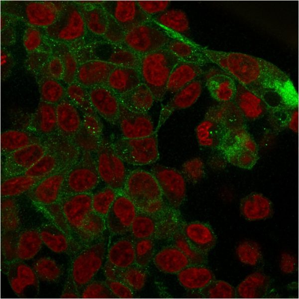 Immunofluorescence staining of PFA-fixed HepG2 cells with Catenin, gamma Mouse Monoclonal Antibody (rCTNG/1664) followed by goat anti-Mouse IgG-CF488 (Green). Nuclei are labeled with Reddot (Red).