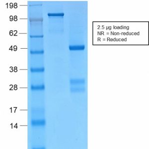SDS-PAGE Analysis of Purified Catenin, gamma Rabbit Monoclonal Antibody (CTNG/2155R). Confirmation of Purity and Integrity of Antibody.