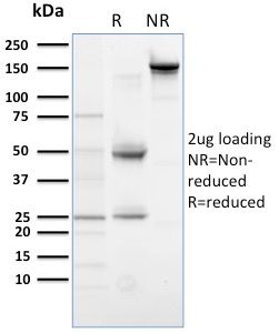 SDS-PAGE Analysis of Purified PLK1 Mouse Monoclonal Antibody (AZ44). Confirmation of Purity and Integrity of Antibody.