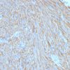 CD117 / c-Kit (Marker for Gastrointestinal Stromal Tumors) Antibody - Image 3