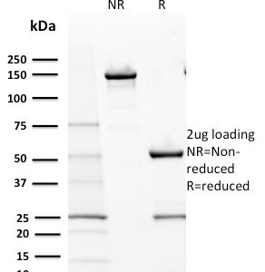 SDS-PAGE Analysis of Purified CD117 Mouse Monoclonal Antibody (KIT/2670). Confirmation of Purity and Integrity of Antibody.