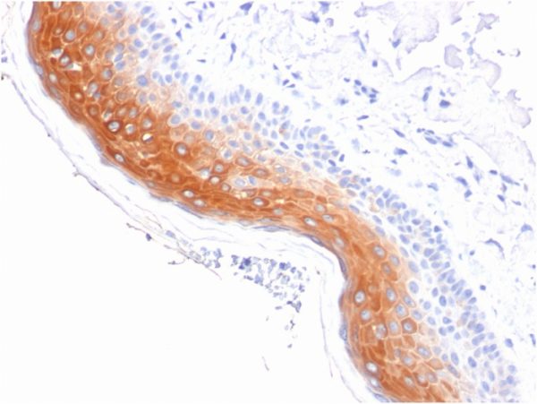 Formalin-fixed, paraffin-embedded human Skin stained with Cytokeratin 1 Mouse Monoclonal Antibody (KRT1/1840).