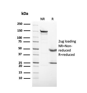 SDS-PAGE Analysis. Purified KRT3 Mouse Monoclonal Antibody (KRT3/2542). Confirmation of Purity and Integrity of Antibody.