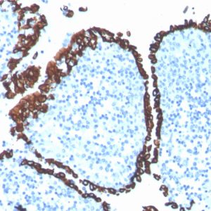 Formalin-fixed, paraffin-embedded human tonsil stained with Cytokeratin 5 Recombinant Rabbit Monoclonal Antibody (KRT5/4245R).