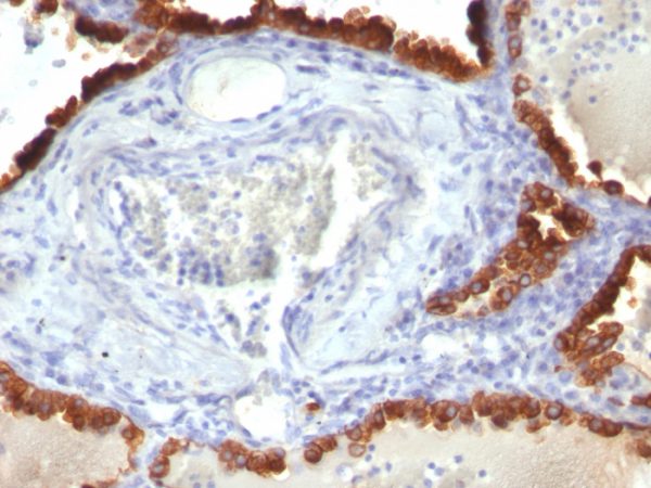 Cytokeratin 7 (Glandular and Transitional Epithelial Marker) Antibody - Image 2