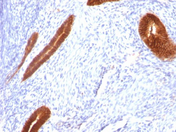 Cytokeratin 7 (Glandular and Transitional Epithelial Marker) Antibody - Image 3