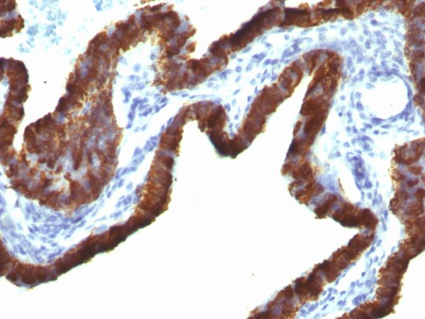 Cytokeratin 7 (Glandular and Transitional Epithelial Marker) Antibody