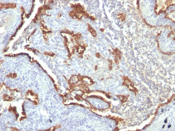 Cytokeratin 7 (Glandular and Transitional Epithelial Marker) Antibody - Image 2