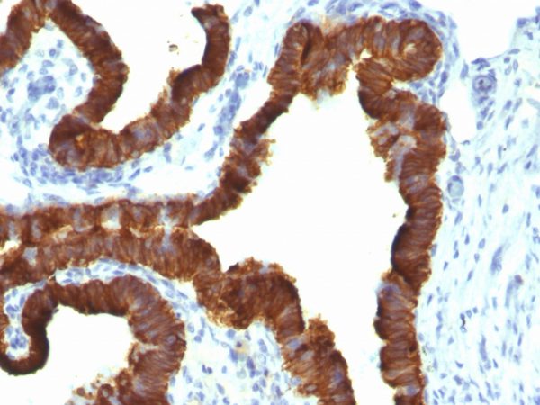 Cytokeratin 7 (Glandular and Transitional Epithelial Marker) Antibody - Image 2