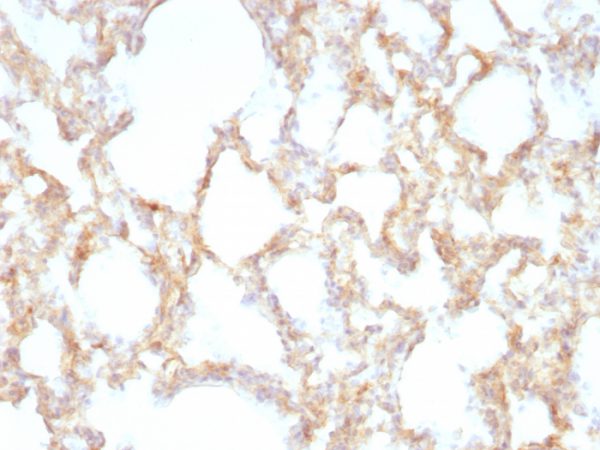 Cytokeratin 7 (Glandular and Transitional Epithelial Marker) Antibody - Image 4