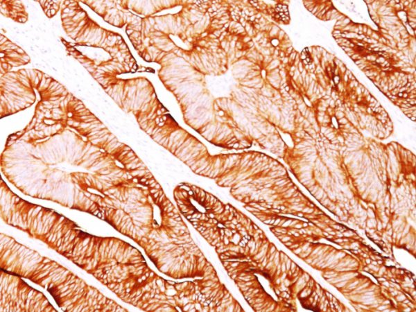 Cytokeratin 8 (KRT8) Antibody