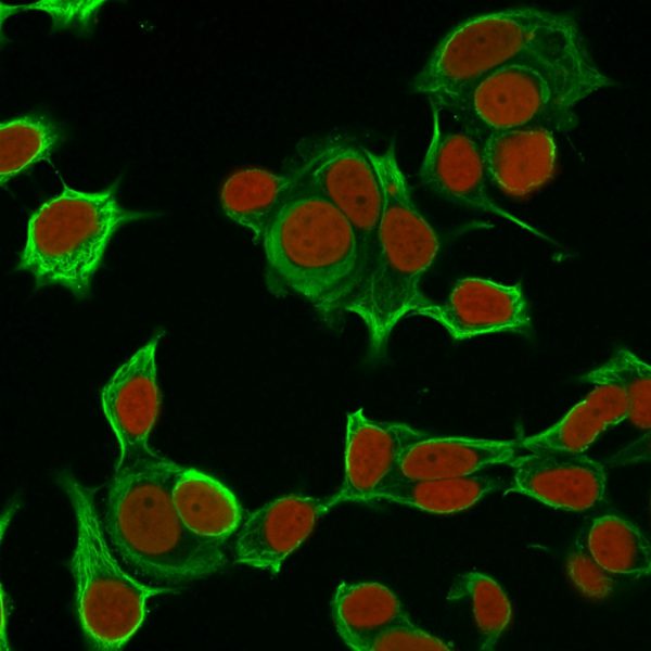 Cytokeratin 8 (KRT8) Antibody - Image 4