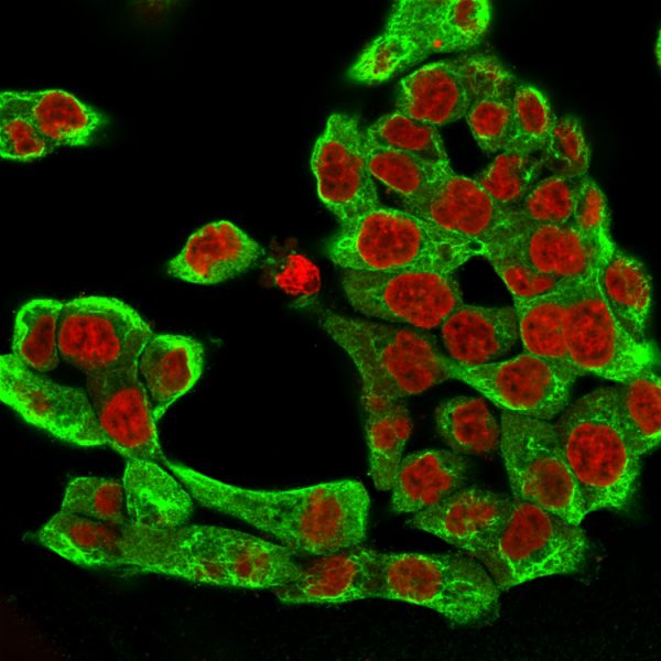 Cytokeratin 8 (KRT8) Antibody - Image 5