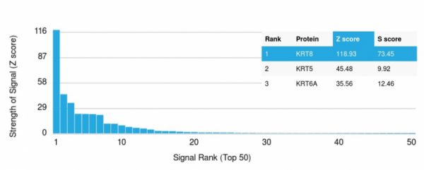 Analysis of Protein Array containing more than 19,000 full-length human proteins using Cytokeratin 8 Mouse Monoclonal Antibody (KRT8/2115). Z- and S- Score: The Z-score represents the strength of a signal that a monoclonal antibody (MAb) (in combination with a fluorescently-tagged anti-IgG secondary antibody) produces when binding to a particular protein on the HuProtTM array. Z-scores are described in units of standard deviations (SD&apos;s) above the mean value of all signals generated on that array. If targets on HuProtTM are arranged in descending order of the Z-score, the S-score is the difference (also in units of SD&apos;s) between the Z-score. S-score therefore represents the relative target specificity of a MAb to its intended target. A MAb is considered to specific to its intended target, if the MAb has an S-score of at least 2.5. For example, if a MAb binds to protein X with a Z-score of 43 and to protein Y with a Z-score of 14, then the S-score for the binding of that MAb to protein X is equal to 29.