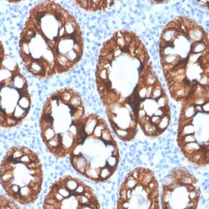 Formalin-fixed, paraffin-embedded human colon stained with Cytokeratin 8 Recombinant Mouse Monoclonal Antibody (rKRT8/4209).