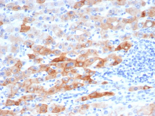 Recombinant Cytokeratin 8 (KRT8) Antibody