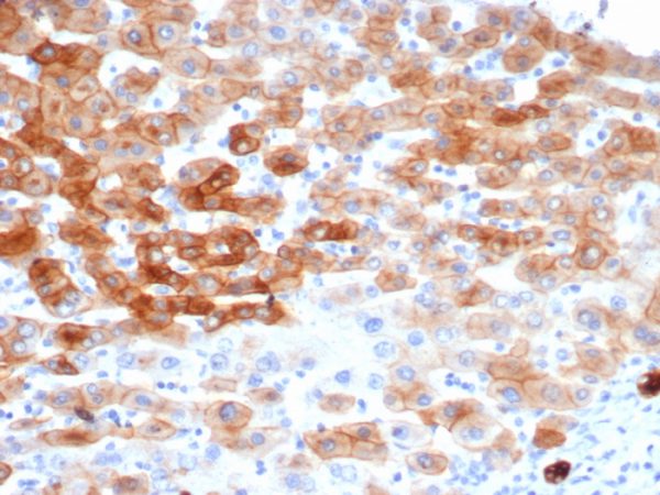 Recombinant Cytokeratin 8 (KRT8) Antibody - Image 2