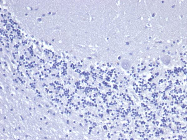 Recombinant Cytokeratin 8 (KRT8) Antibody - Image 3