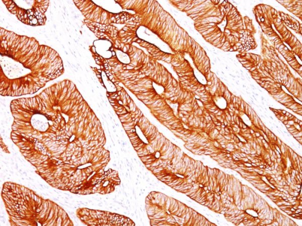 Cytokeratin 8 (KRT8) Antibody - Image 2