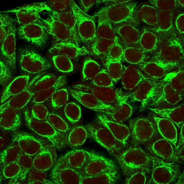 Cytokeratin 8 (KRT8) Antibody - Image 3