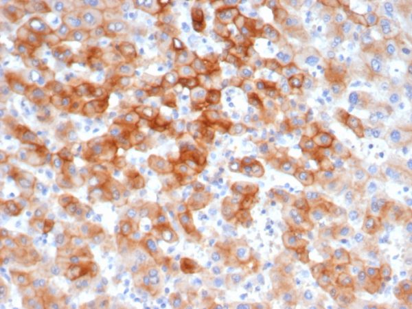 Formalin-fixed, paraffin-embedded human colon stained with Cytokeratin 8 Recombinant Rabbit Monoclonal Antibody (KRT8/6472R).