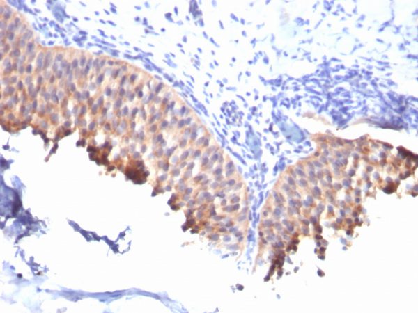 Cytokeratin 10 (Suprabasal Epithelial Marker) Antibody