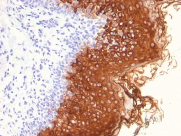 Cytokeratin 10 (Suprabasal Epithelial Marker) Antibody - Image 2